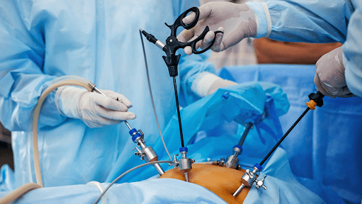 cirurgia-bariatrica-cfm-amplia-regras-e-inclui-adolescentes-cfm-reduz-o-imc-necessario-para-fazer-bariatrica-desde-que-a-pessoa-tenha-outras-doencas-imagem-sbcbm-tvt-news