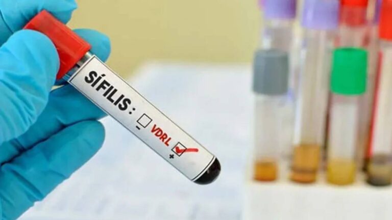 ministerio-da-saude-lanca-campanha-de-enfrentamento-a-sifilis-em-2025-a-oferta-do-teste-rapido-hiv-sifilis-aumentou-em-mais-de-40-foto-arquivo-abr-tvt-news
