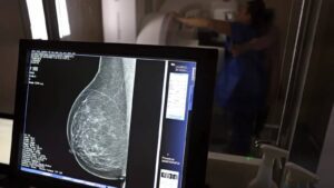 lula-sanciona-lei-que-amplia-acesso-das-mulheres-a-mamografia-pelo-sus-deteccao-precoce-aumenta-as-chancas-de-cura-do-cancer-de-mama-foto-jose-cruz-agencia-brasil-tvt-news