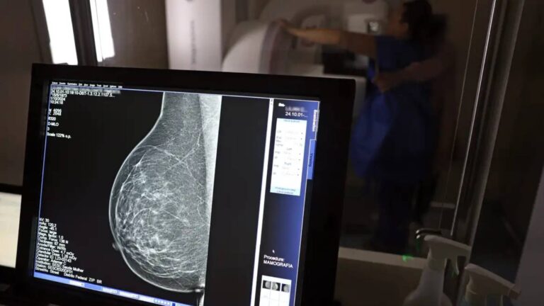 lula-sanciona-lei-que-amplia-acesso-das-mulheres-a-mamografia-pelo-sus-deteccao-precoce-aumenta-as-chancas-de-cura-do-cancer-de-mama-foto-jose-cruz-agencia-brasil-tvt-news