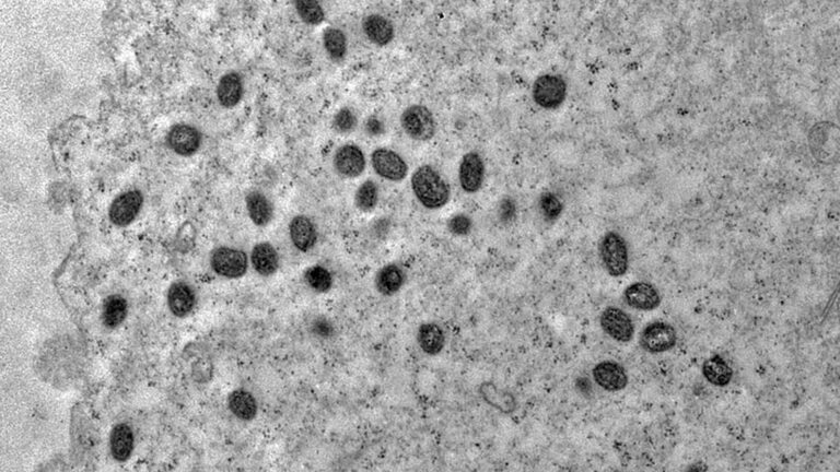 Mpox-avanca-no-Brasil-entenda-o-que-e-a-doenca-sintomas-e-formas-de-transmissao-debora-f-barreto-vieira-ioc-fiocruz-tvt-news
