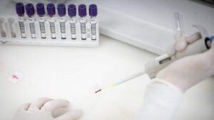 Da Redação 29 Exames-descartam-ebola-em-imigrante-da-Republica-Democratica-do-Congo-pablo-jacob-governo-sp-tvt-news