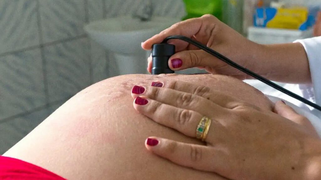 Risco-de-morte-materna-cai-ate-31-entre-quem-recebe-o-Bolsa-Familia-arquivo-mds-tvt-news