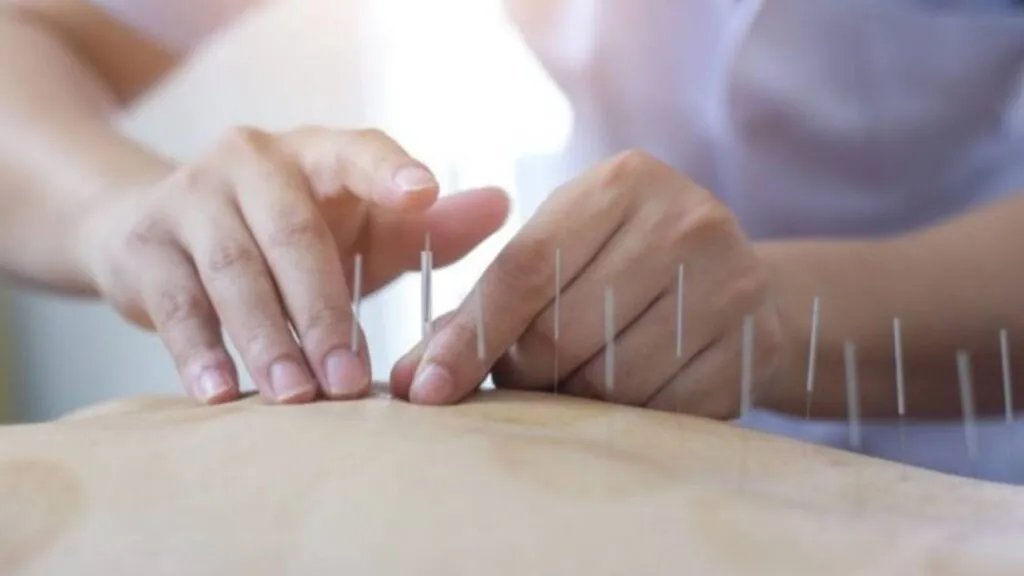 exercicio-profissional-de-acupuntura-e-regulamentado-no-brasil-lei-assegura-o-exercicio-profissional-a-pessoas-com-formacao-superior-em-acupuntura-foto-divulgacao-tvt-news